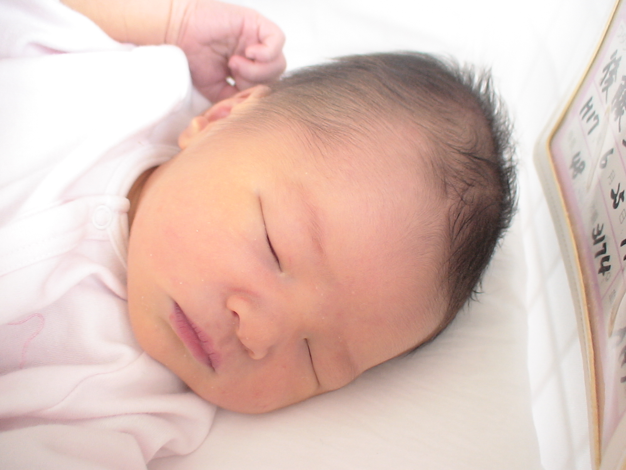 0以上 赤ちゃん 吸引分娩 頭の形 無料の赤ちゃんの画像